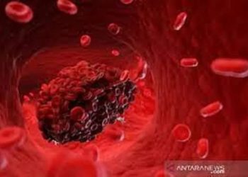 Ilustrasi : pembekuan darah (Antara/Shutterstock)