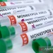 Tabung mini hasil pengujian yang bertanda "positif dan negatif virus cacar monyet" terlihat dalam ilustrasi yang diambil pada Senin (23/5/2022). ANTARA/REUTERS/Dado Ruvic/tm/am.