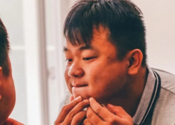 Ilustrasi seorang pria memeriksa jerawat di wajah (Pixabay)